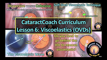CataractCoach 1595: curriculum lesson 6: viscoelastics (OVDs)