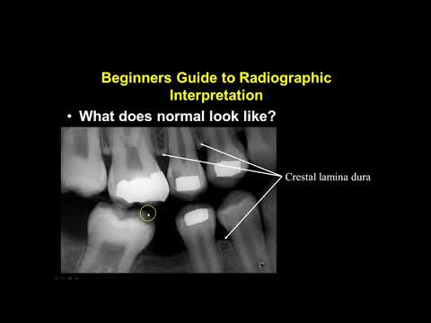 Video: Kdo je naredil prvi intraoralni radiograf?