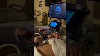 Liver Ultrasound Scanning Protocol | AIMS Education