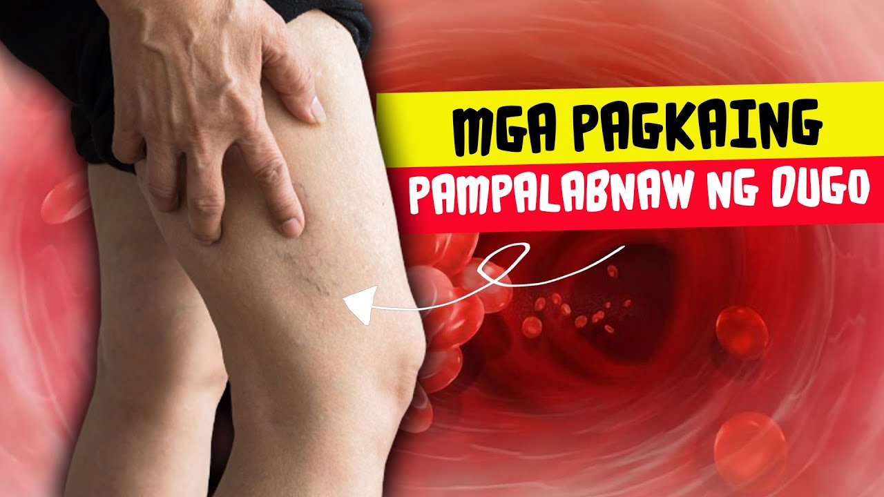 8 Pagkaing Pampalabnaw Ng Dugo 8 Natural Blood Thinning Foods To 