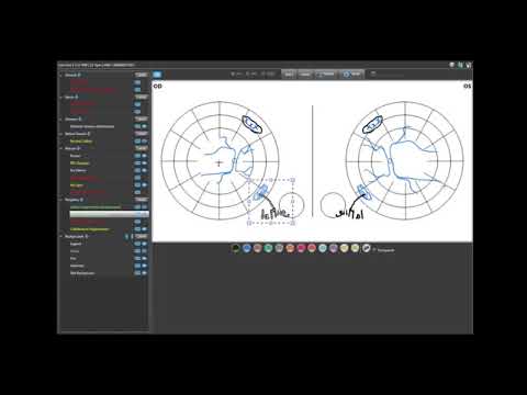 Nextech IntelleChart Pro - IntelleDraw