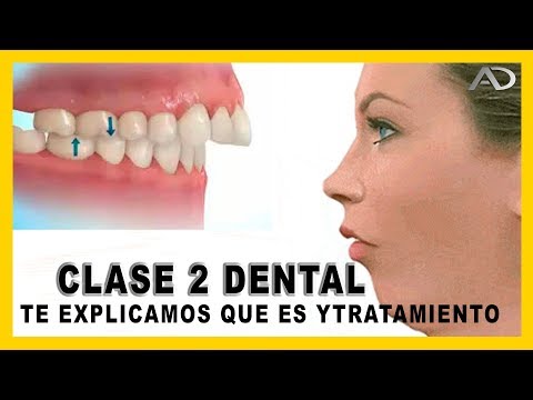 Video: ¿Deben tocarse los dientes superiores e inferiores?