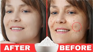 BAKING SODA removes AGE SPOTS: only 3 ingredients!