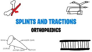 SPLINTS AND TRACTIONS | ORTHOPAEDICS | MED VIDS MADE SIMPLE