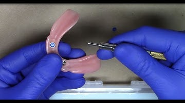 Tips and tricks for using the LOCATOR® Core Tool