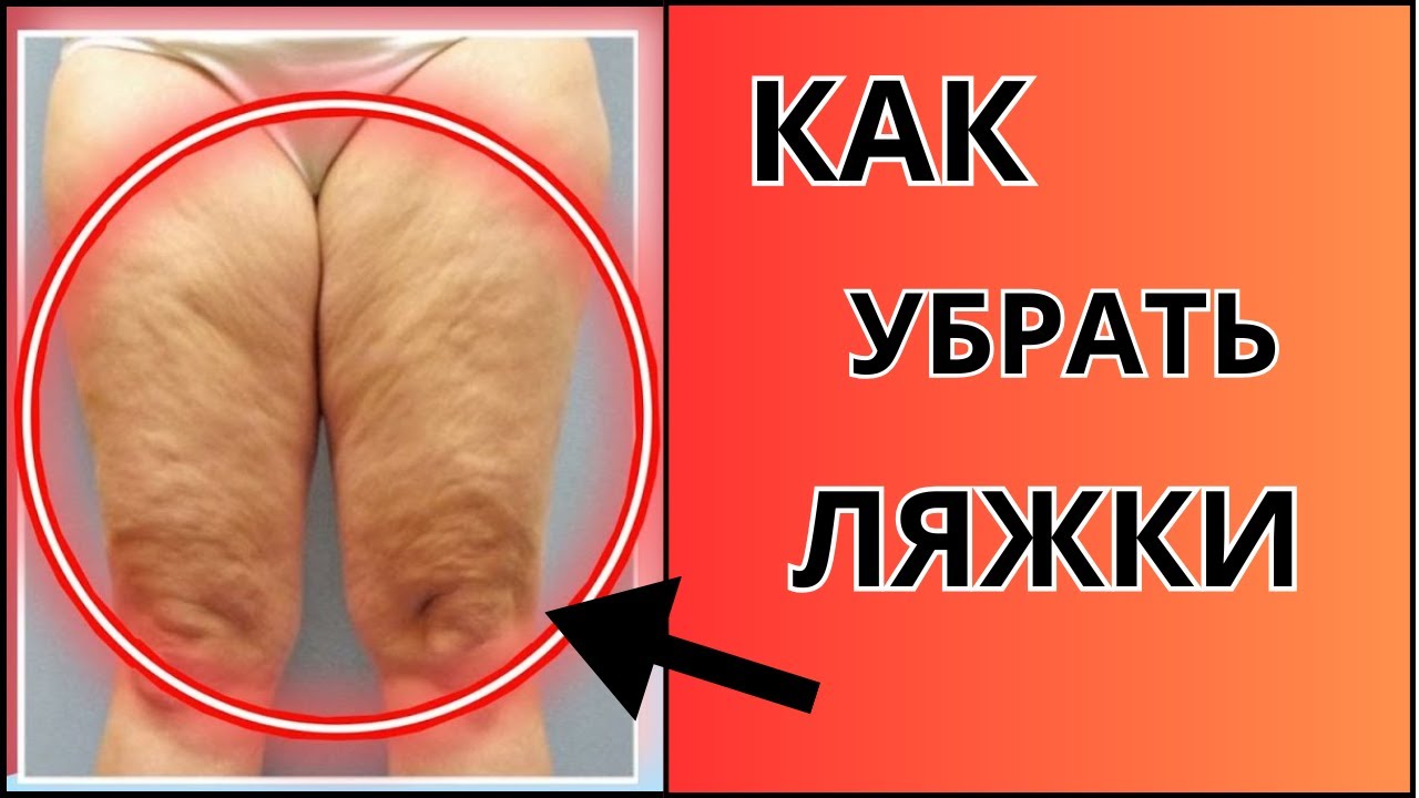 Попытка убедить девушку раздвинуть ляжки