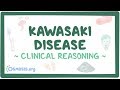 Kawasaki disease ~clinical reasoning~