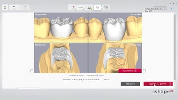 Automate crown in Unite workflow