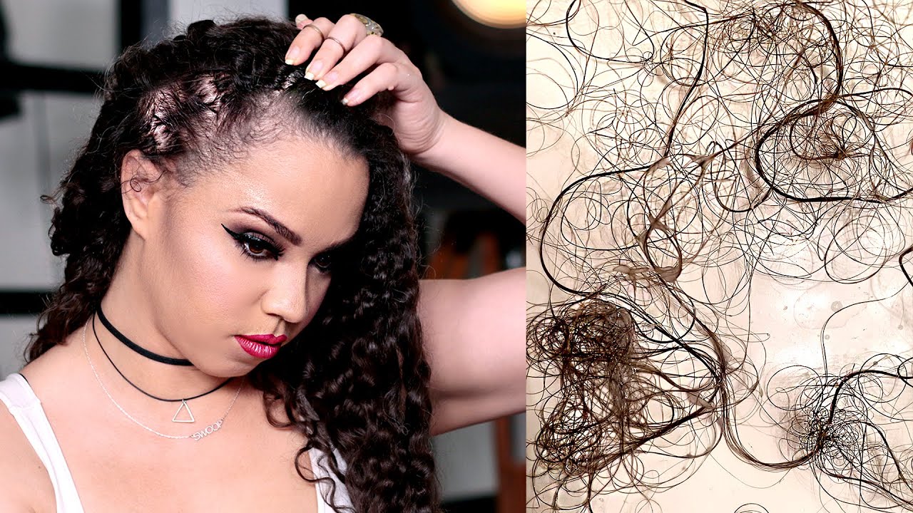 MY HAIR IS FALLING OUT (with Pictures) - YouTube