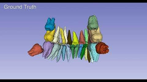 Tooth Segmentation from CBCT Scans Using Dentition-Based Learning
