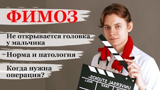 Фимоз. Не открывается головка у мальчика. До какого возраста должна открыться? Когда нужна операция?