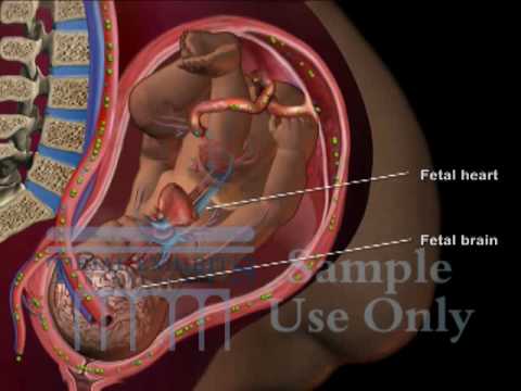 Umbilical Cord Compression - Maternal Fetal Circulation Medical 3D Animation  - YouTube