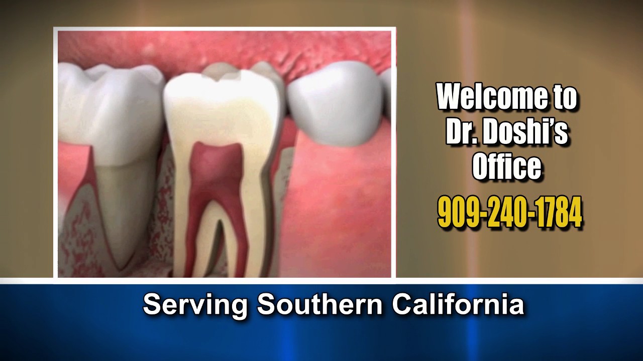 Single visit Root canal treatment