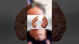 Are Antibiotics Harmful for Kidneys??? Amoxicillin Kidney Disease
