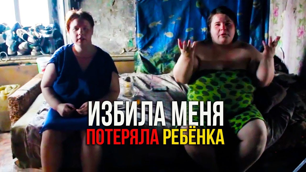 УЖАС😩ПОТЕРЯЛА РЕБЕНКА. Я НА НИХ ОБИЖЕНА. ИНВАЛИДЫ ЖИВУТ КАК ВРАГИ