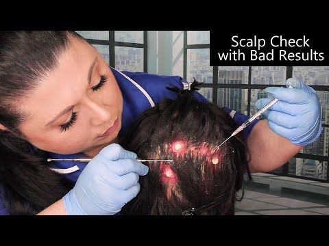 ASMR Scalp Check with Bad Results (Acne Removal, Scalp Treatment, Whispering) Medical Roleplay