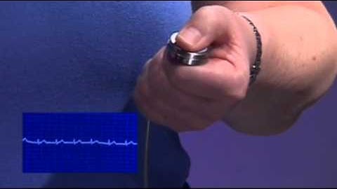 Accurate ECG Measurement made Easy