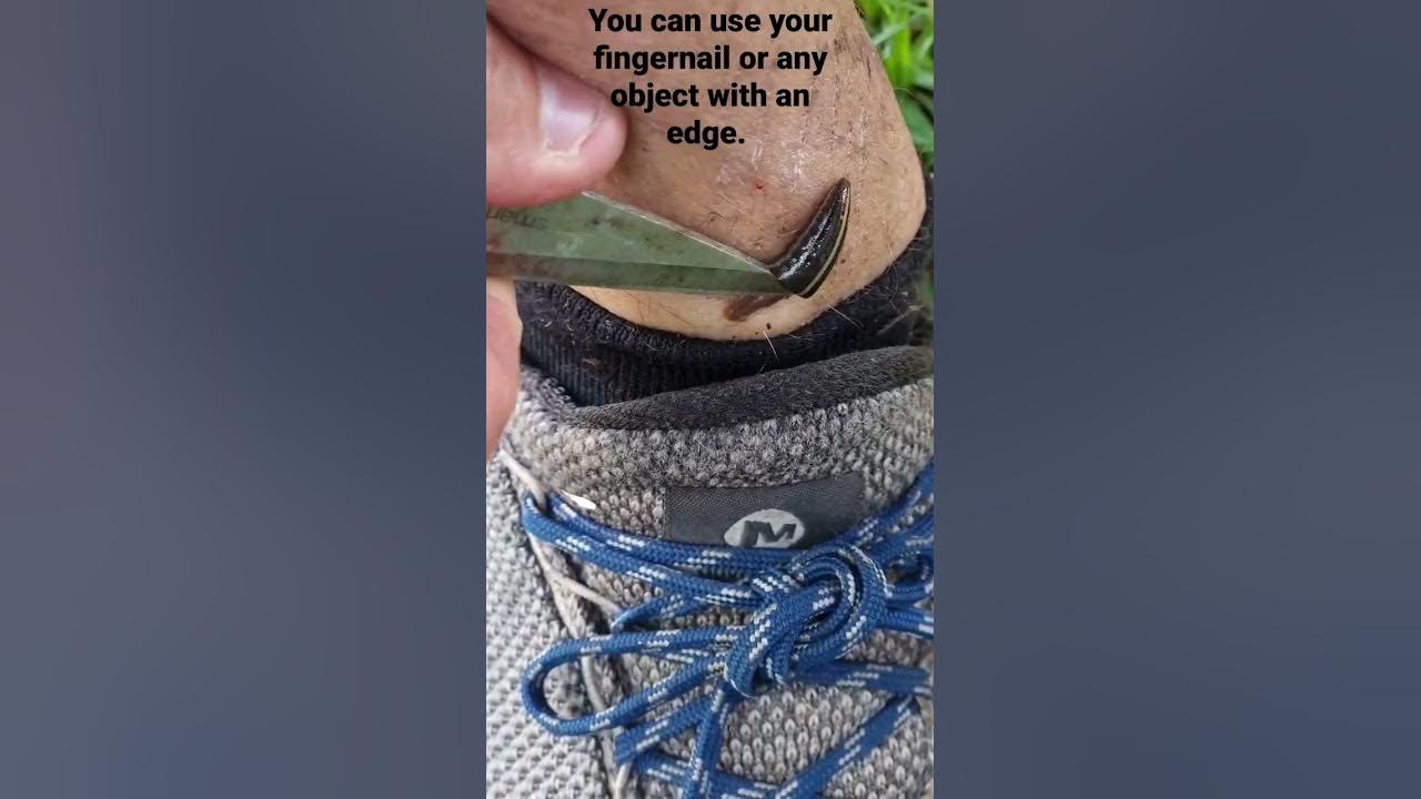 how-to-remove-leeches-youtube