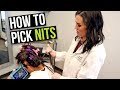 How to Remove Head Lice Eggs - Nit and Lice Picking in Thick Hair