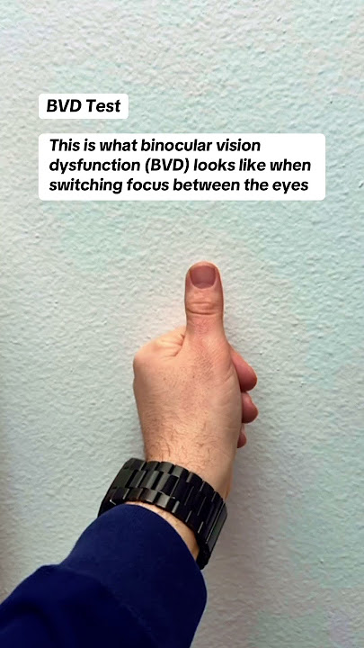 This is what binocular vision dysfunction (BVD) can look like when switching focus between the eyes!