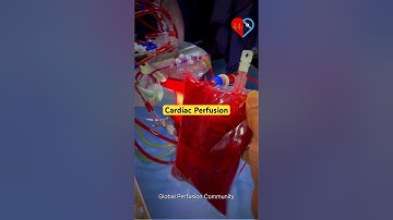 Perfusion technology | Do you know who is cardiac Perfusionist ? #texasheartinstitute #americanheart