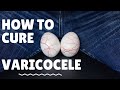 How to cure varicocele without surgery 