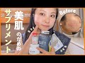 【インナーケア】管理栄養士が美肌のために飲んでるサプリメント4つ紹介!🌟