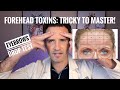 Forehead toxin  ideal candidates  dosing