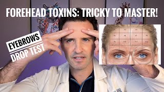 Forehead toxin : ideal candidates & dosing