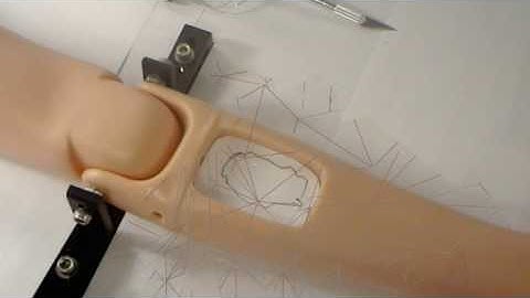 The surgical navigation