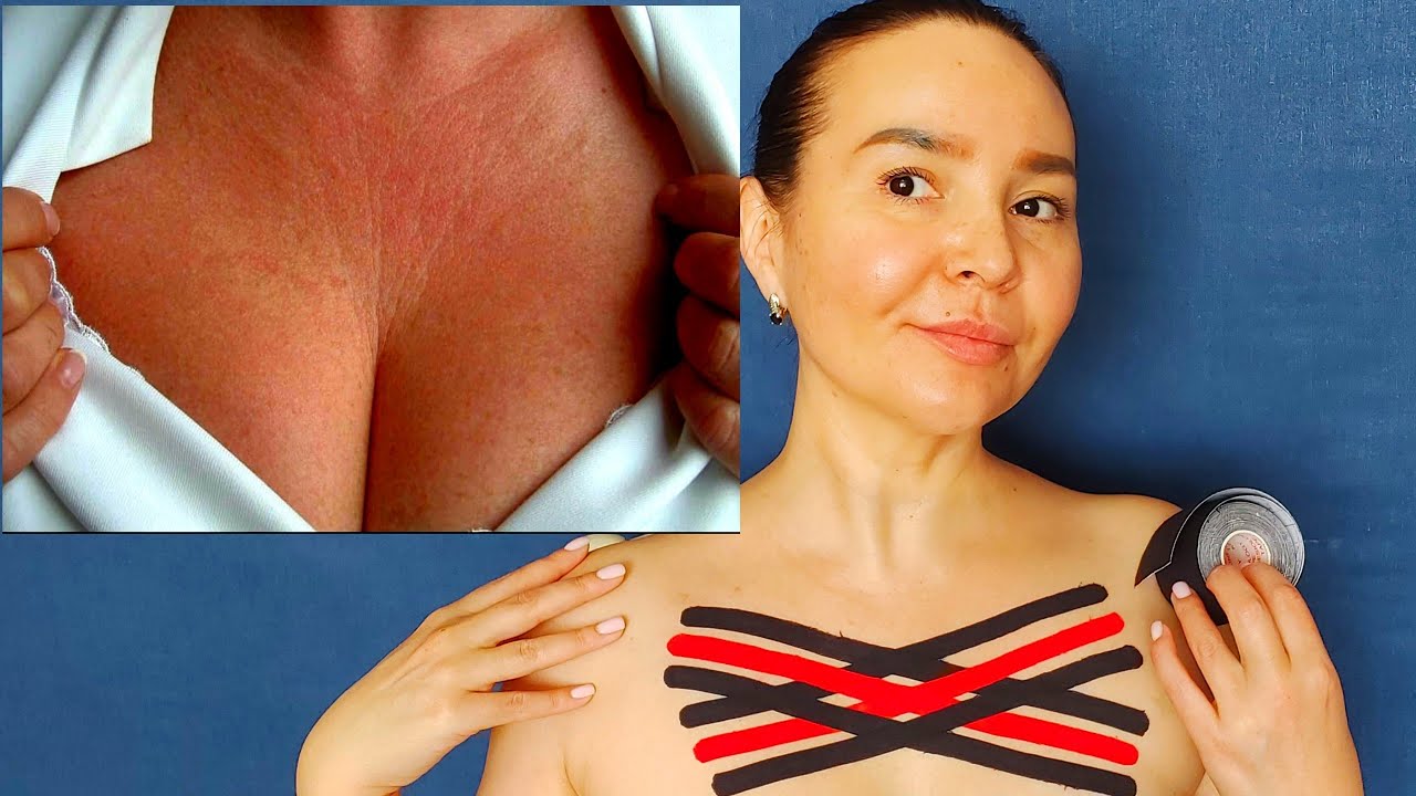 Chest Wrinkles How to Remove and Prevent with Kinesio Taping 