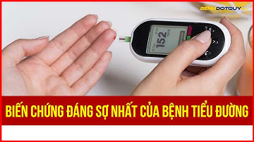 Biến chứng đáng sợ nhất của bệnh tiểu đường