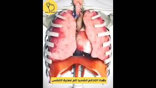 بهذا التناغم الشديد تتم عملية التنفس    سمعها