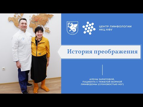 В НКЦ КФУ поставили на ноги пациентку с тяжелой формой «слоновости»