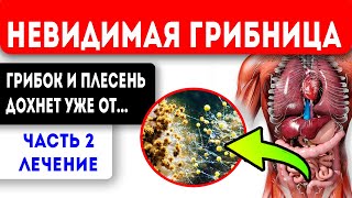 Эта еда паразиту не оставит шанса, а телу сил придаст! Плесень (грибок) в организме. Лечение Часть 2