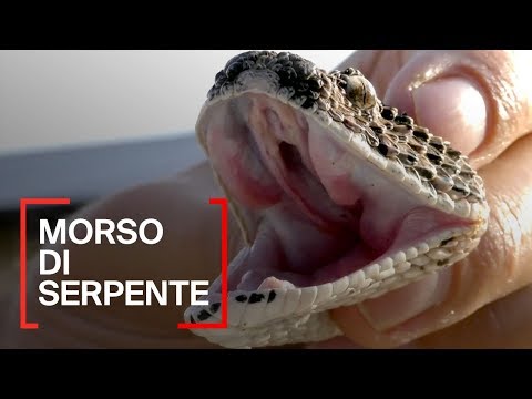 Video: Morso Di Serpente
