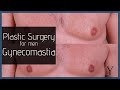 Gynecomastia surgery  atlanta ga  y plastic surgery