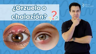 ¿Orzuelo o Chalazión?