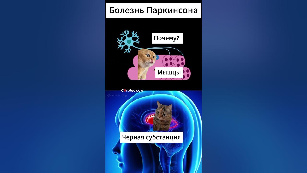 Болезнь Паркинсона простыми словами 😂 - YouTube
