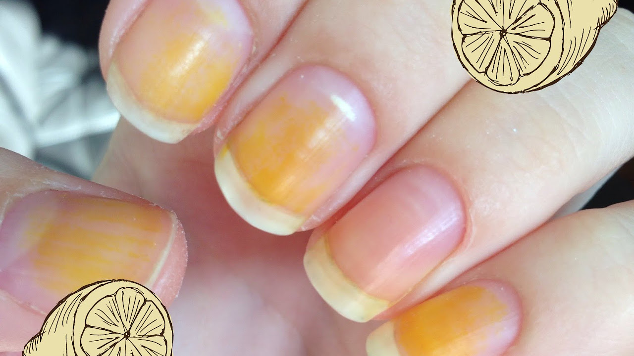 How to Whiten Nails That Have Turned Yellow | Fox Podiatry