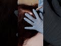 ASMR School Nurse LICE Check on Scalp | Lice Removal with Tweezers on   ⁨@DaisyJASMR #asmr #shorts