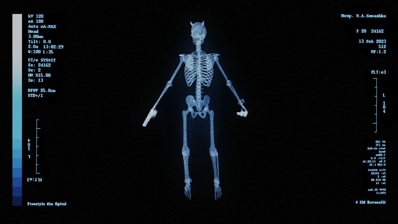 RAVA - Freestyle Din Spital (Visualizer) - YouTube