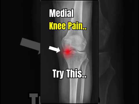 This will solve your Knee Pain. 100% Working.