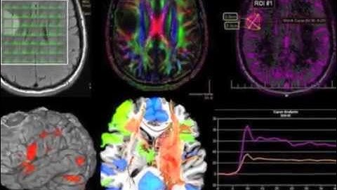 What is Functional Neurology?