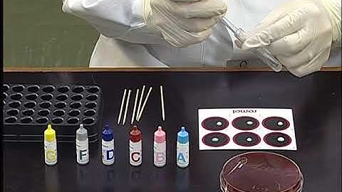 Beta haemolytic streptococci - Latex grouping