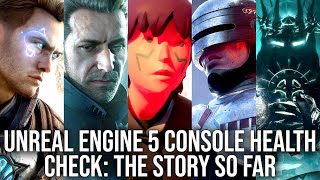 Unreal Engine 5 Console Health Check: Every Major UE5 Game Tested on PS5 \& Xbox Series X\/S