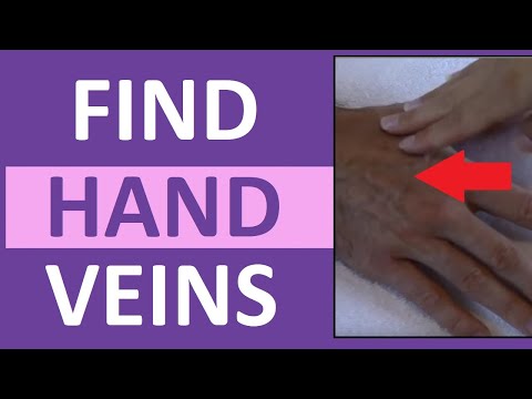 How To Find A Vein In The Hand For Starting IVs & Drawing Blood