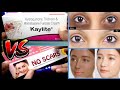 हद से ज्यादा तेजी से गोरा करती है ये क्रीमे No Scars V&#39;s Kaylite Fairness cream review // SG Support