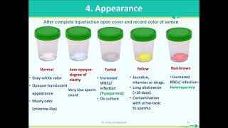 Semen Analysis-Part 1- Macroscopic Examination