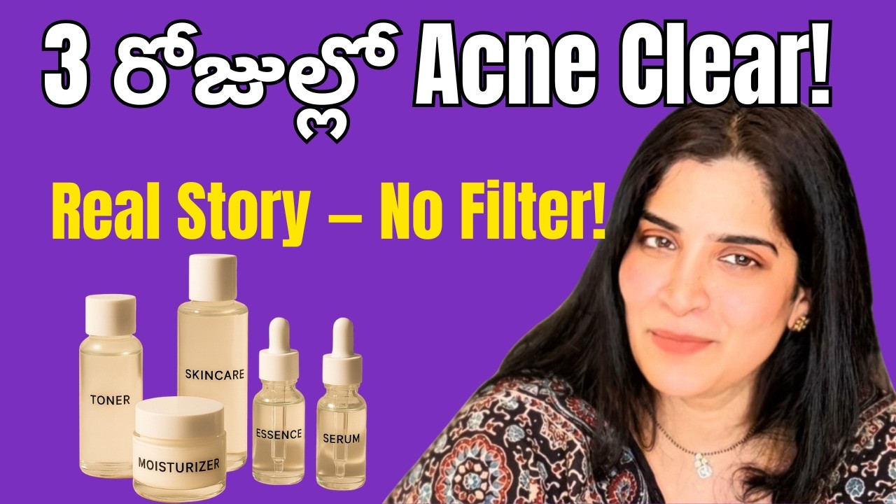 3 Days lo ACNE CLEAR | How I cleared my acne in 72 hours? - YouTube